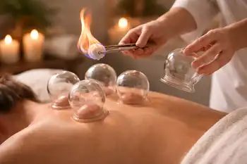 Vuurcupping *NIEUW!* - Cupping by Faye - Groningen