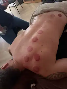 Wat je beroep ook is… je lichaam draagt meer dan je denkt Cupping by Faye - Groningen